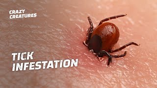 WARNING: The Most Horrific Tick Infestations