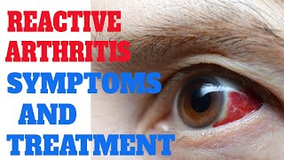 Reactive Arthritis:  Reiter’s syndrome | What is the REAL cause of Problems with Joints