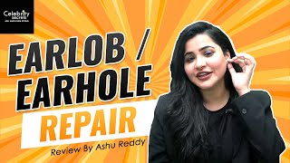 Ashu Reddy Earhole Repair | Ear Lob Repair - Celebrity Secrets