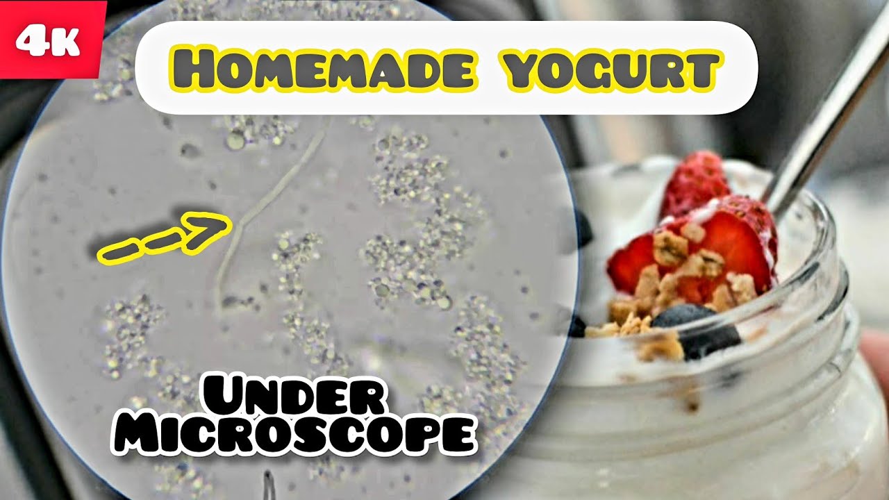Yogurt Under Microscope At William Fellows Blog