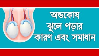 অন্ডকোষ ঝুলে যাওয়ার কারণ এবং এর সঠিক সমাধান