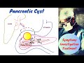 Pancreatic Cysts