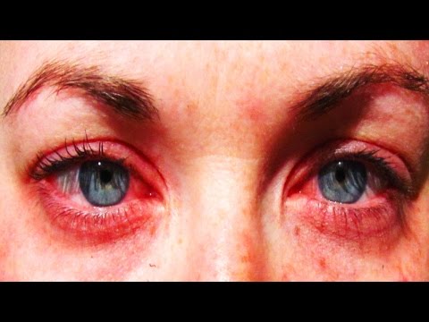 25 Of The Most Common Allergies 25 Of The Most Common Allergies