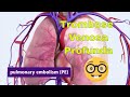 Trombose Venosa Profunda (TVP) e Embolia Pulmonar (EP).