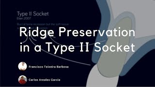 Socket Preservation  In a Type II Socket-  Elian Classification