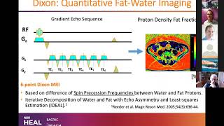 Dr. Roland Krug (UCSF) “Muscle MRI: methods and applications”