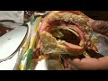 subway italian b.m.t vs wawa italian hoagie