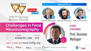 Challenges in Fetal Neurosonography / 30 Nisan 2021
