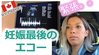 【カナダ双子妊娠】 最後のエコー(Vlog＃7)