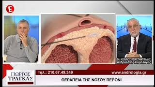 Δρ. Κωνσταντίνος Κωνσταντινίδης - Νόσος Peyronie (Πεϊκή κάμψη)