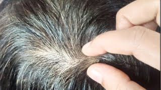 Scalp ASMR: The Most Relaxing Search for Head Lice