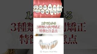 歯列矯正3種類の特徴と注意点#矯正歯科 #歯列矯正 #徳島歯医者 #歯医者