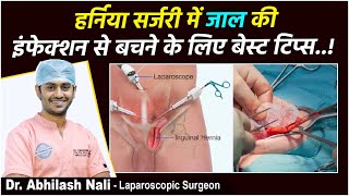 हर्निया सर्जरी के पहले | Sterilization Precautions Before Hernia Surgery in Hindi | Dr Abhilash Nali