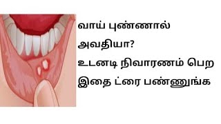 வாய் புண்ணை குணமாக்கும் எளிய வீட்டு வைத்தியங்கள் | Home remedies for mouth ulcer | Safiyas Granary