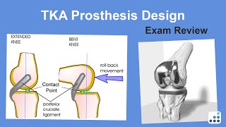 TKA Prosthesis Design Exam Review - Michael Bolognesi, MD