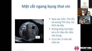 06 Siêu âm quý 2 thai kỳ (các mặt cắt khảo sát hình thái thai) - ThS.BS. Hà Tố Nguyên