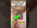 Preguntas de anatomía #6