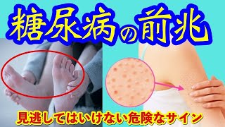 恐ろしい糖尿病！絶対に見逃してはいけない危険なサインとは？