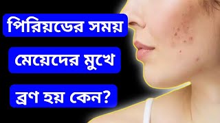 ব্রণ কেন হয়? Why does acne occur? ব্রণ হওয়ার কারন ও প্রতিকার। AM-LOVERamTV।