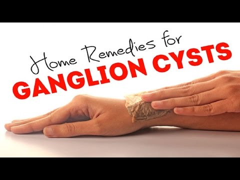 5 Home Remedies for Ganglion Cysts. 5 Home Remedies for Ganglion Cysts.