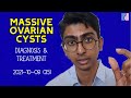 Massive Ovarian Cysts: How we treat this condition