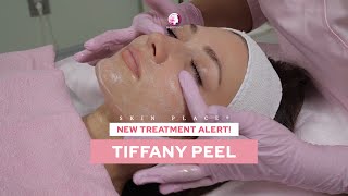 Skin Place Tiffany Peel #TiffanyPeel #FacialTreatment #skincare