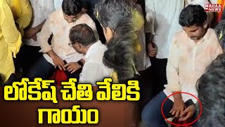 లోకేష్ చేతి వేలికి గాయం | Nara Lokesh | Yuvagalam | Mahaa News