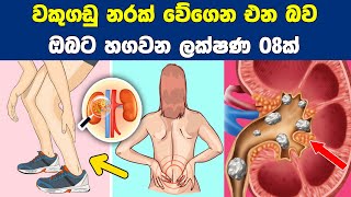 වකුගඩු නරක් වේගෙන එන බව ඔබට හගවන ලක්ෂණ 08 ක් | 08 Signs That Your Kidneys Are Failing