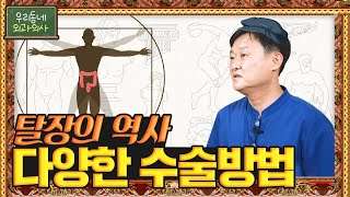 [탈장병원] 탈장의 역사📜 다양한 탈장수술방법!