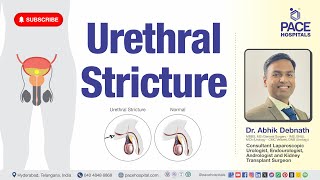 Urethral Stricture - Type, Cause, Symptoms, Complication, Diagnosis & Treatment