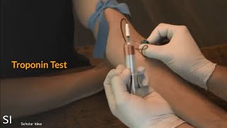 What is Cardiac Troponin?