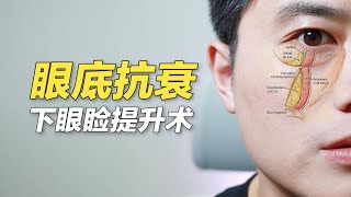 眼袋\u0026苹果肌下垂！一举两得的眼整形手术方法有没有？ (feat:李朴频道LpChannel)