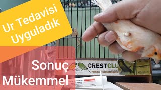 Ur Tedavisi ve mükemmel sonuç