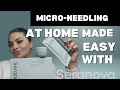 How I used the seranova micro infusion kit for glowing skin!