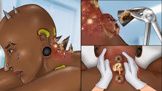 ASMR Popping pustules on nape piercing implant animation | Body modification