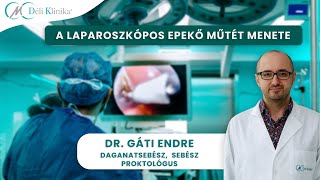 Hogyan zajlik az epekövek laparoszkópos eltávolítása? | Dr. Gáti Endre