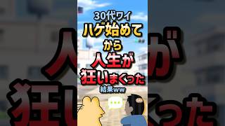 【2ch面白スレ】30代でハゲ