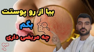 چطوری از طریق پوست متوجه شویم  که  درگیر چه بیماری هستیم ؟