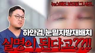 눈밑 지방 재배치, 하안검 수술의 가장 무서운 부작용 '실명'