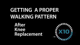 Walking Pattern After Knee Replacement