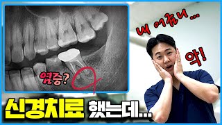 Why do teeth after endodontic treatment hurt again?