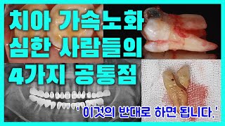 치아 오래 못쓰고 크라운, 임플란트 하는 사람들의 공통점