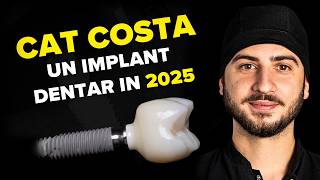 Cat costa un implant dentar? Afla pretul unui implant dentar in 2025