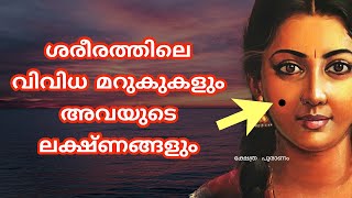 സ്ത്രീക്കും പുരുഷനും വ്യത്യസ്ഥ ഫലങ്ങൾ തരുന്ന മറുകുകൾ