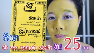 30 ยังแจ๋ว Ep.17 วิธีรักษา ฝ้า กระ จุดด่างดำ รอยสิว หน้าขาวใส งบ 25 บาท