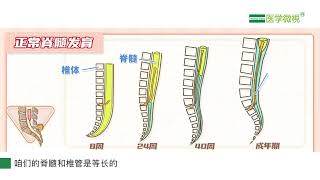 导致脊髓拴系综合征的原因有哪些？