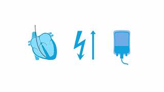 Transvenous pacing: troubleshooting