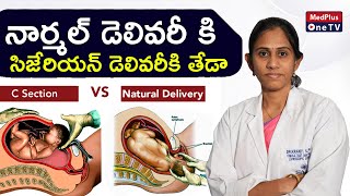 Normal Delivery vs. Cesarean Delivery: What's the Difference? | Dr.Kranti Silpa @MedPlusONETV