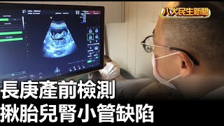 長庚產前檢測 揪胎兒腎小管缺陷 |【民生八方事】| 2023080808 @gtvnews27