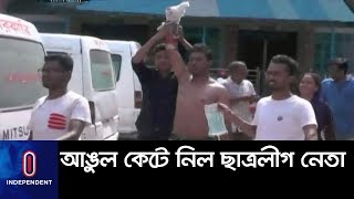 বিরোধের জেরে ব্যবসায়ীর চার আঙ্গুল কেটে ছাত্রলীগের সাধারণ সম্পাদকের সহযোগীরা || Satkhira Clash